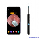 Dụng cụ lấy ráy tai thông minh Xiaomi Bebird R1