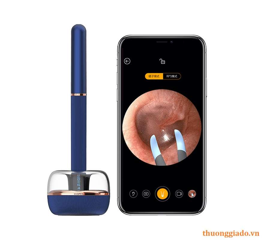 Dụng cụ vệ sinh tai thông minh tích hợp ống nội soi Xiaomi Bebird Note 3