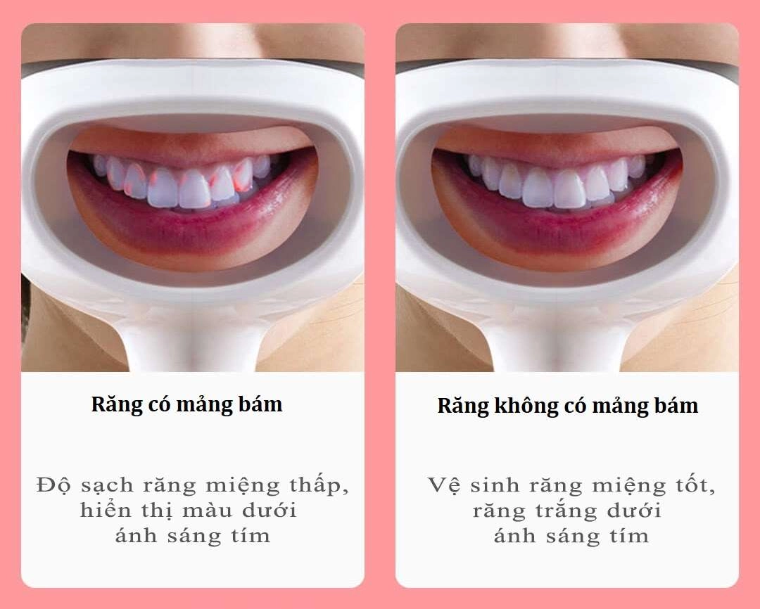 Máy soi mảng bám trên răng Xiaomi YMYM YD1