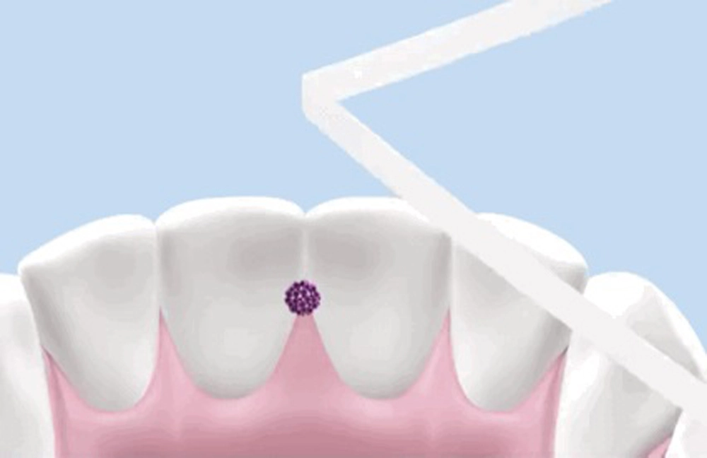 Chỉ tơ nha khoa Xiaomi Doctor B (DoctorBei)