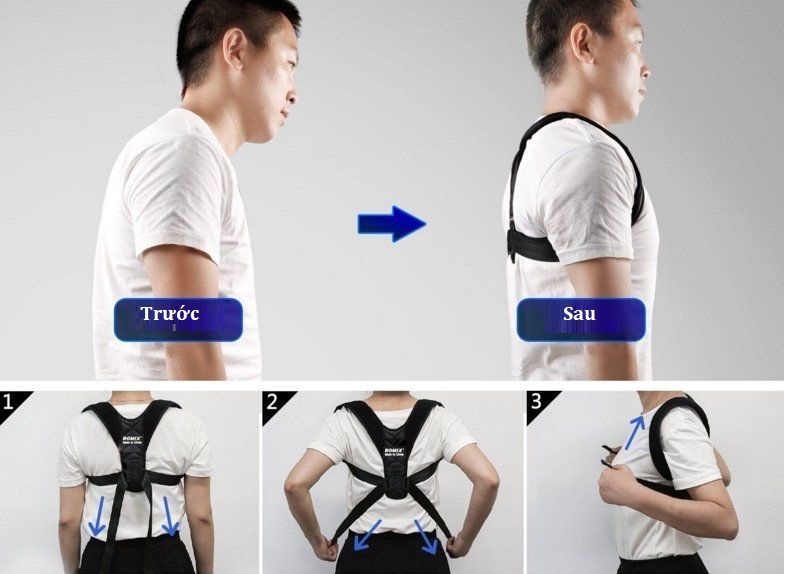 Đai đeo chống gù lưng Romix RH58