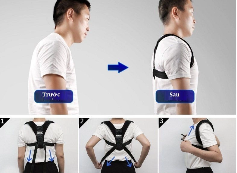 Đai đeo chống gù lưng Romix RH58