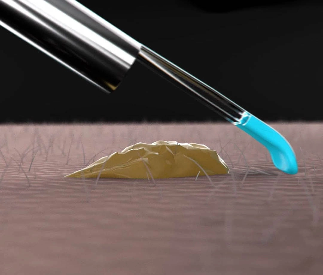 Dụng cụ lấy ráy tai thông minh Xiaomi Bebird M9 Pro