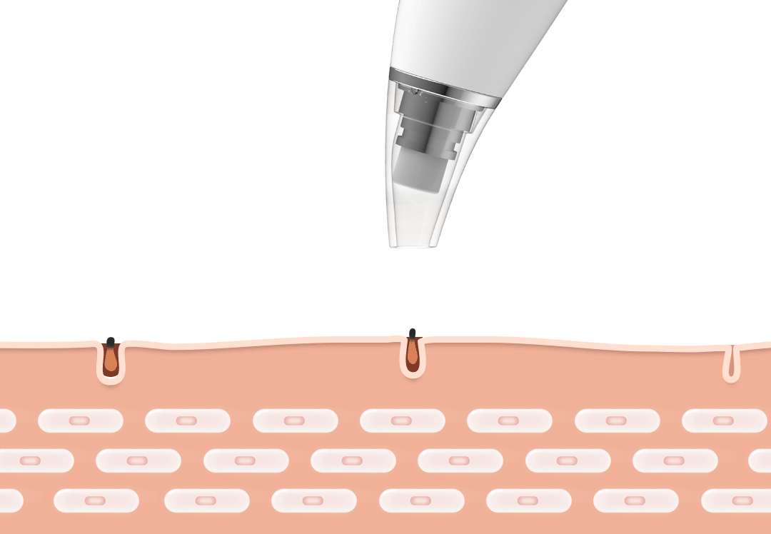 Máy hút mụn đầu đen inFace MS7000 (Xiaomi phân phối)